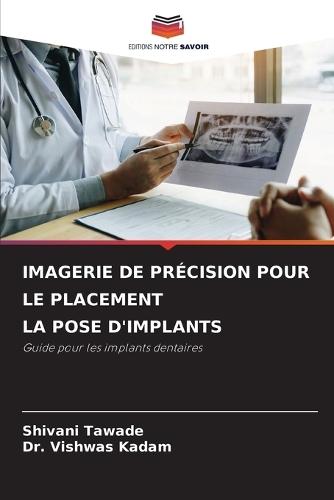 Imagerie de Précision Pour Le Placement La Pose d'Implants