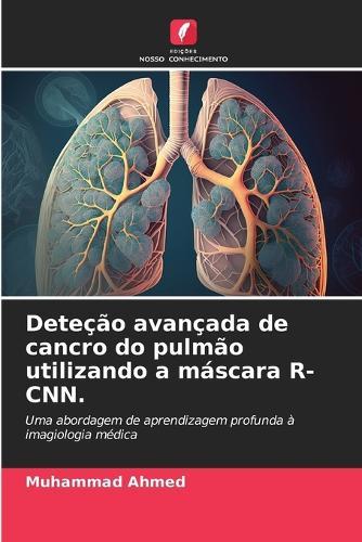 Deteção avançada de cancro do pulmão utilizando a máscara R-CNN.