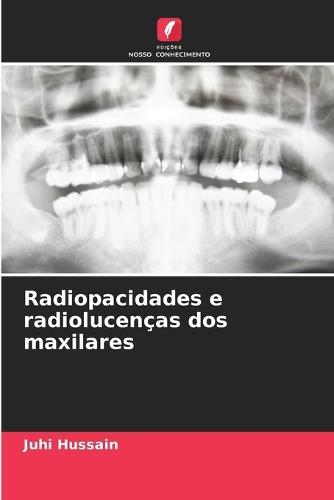 Radiopacidades e radiolucenças dos maxilares
