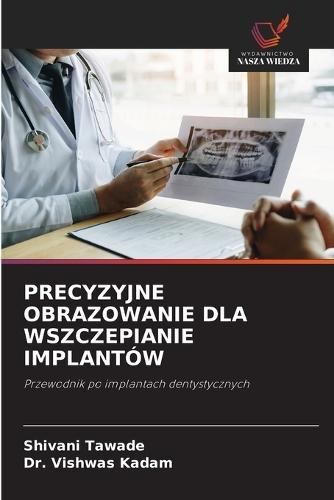 Precyzyjne Obrazowanie Dla Wszczepianie Implantów