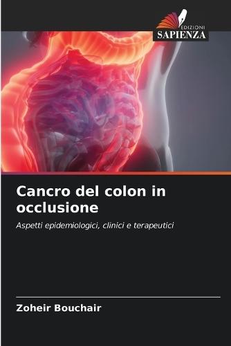 Cancro del colon in occlusione