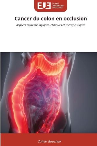 Cancer du colon en occlusion