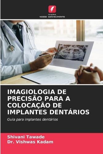 Imagiologia de Precisão Para a Colocação de Implantes Dentários