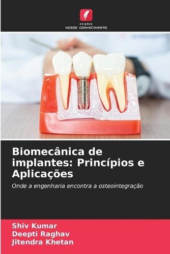 Biomecânica de implantes: Princípios e Aplicações