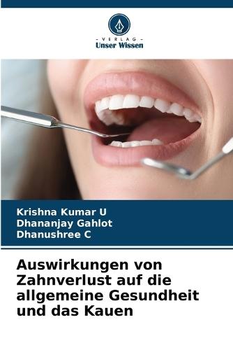 Auswirkungen von Zahnverlust auf die allgemeine Gesundheit und das Kauen
