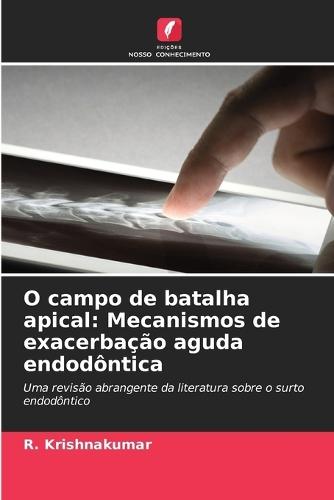 O campo de batalha apical: Mecanismos de exacerbação aguda endodôntica