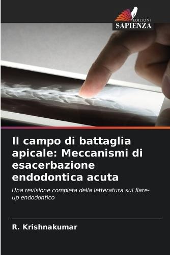 Il campo di battaglia apicale: Meccanismi di esacerbazione endodontica acuta