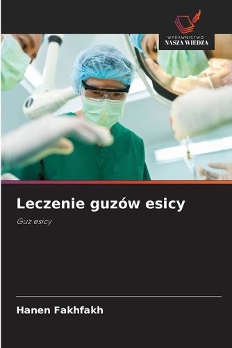 Leczenie guzów esicy