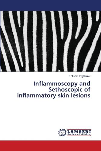 Inflammoscopy and Sethoscopic of inflammatory skin lesions