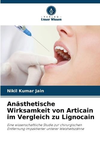 Anästhetische Wirksamkeit von Articain im Vergleich zu Lignocain