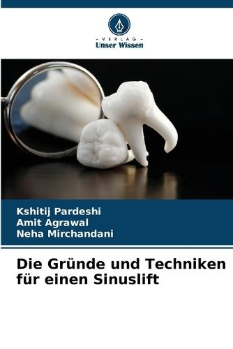 Die Gründe und Techniken für einen Sinuslift