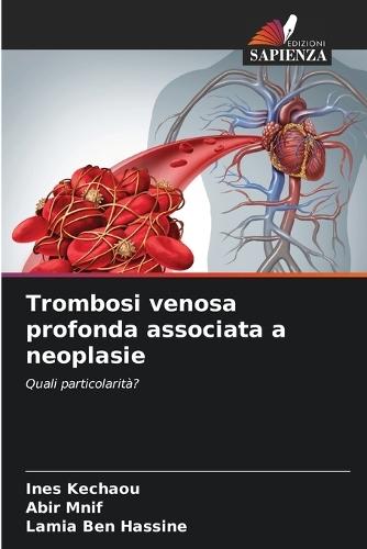 Trombosi venosa profonda associata a neoplasie