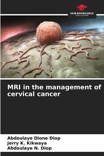 MRI in the management of cervical cancer