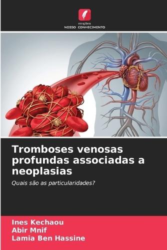 Tromboses venosas profundas associadas a neoplasias