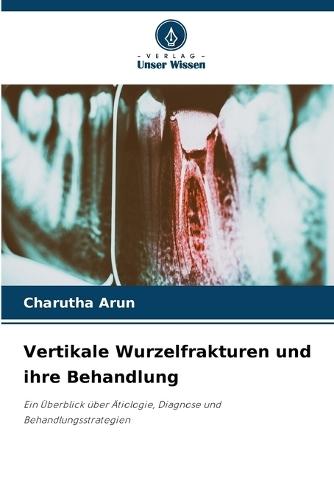 Vertikale Wurzelfrakturen und ihre Behandlung