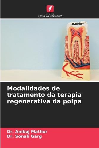 Modalidades de tratamento da terapia regenerativa da polpa