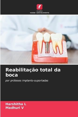 Reabilitação total da boca