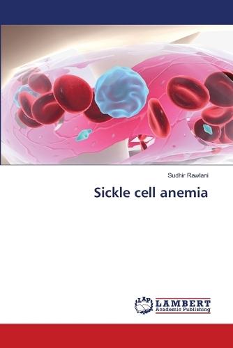 Sickle cell anemia