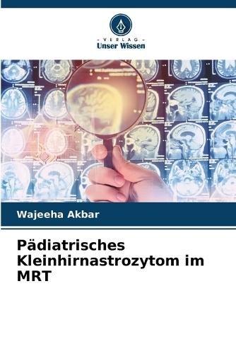 Pädiatrisches Kleinhirnastrozytom im MRT