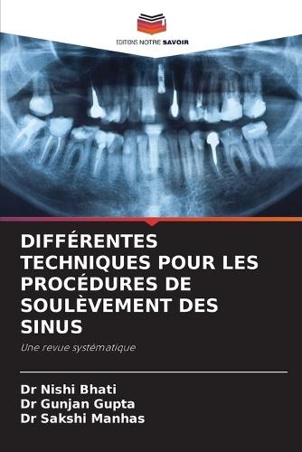 Différentes Techniques Pour Les Procédures de Soulèvement Des Sinus