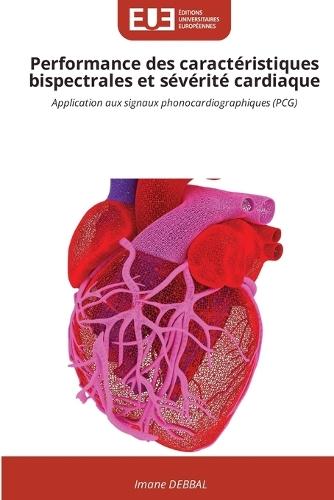 Performance des caractéristiques bispectrales et sévérité cardiaque
