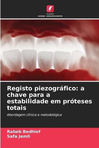Registo piezográfico: a chave para a estabilidade em próteses totais