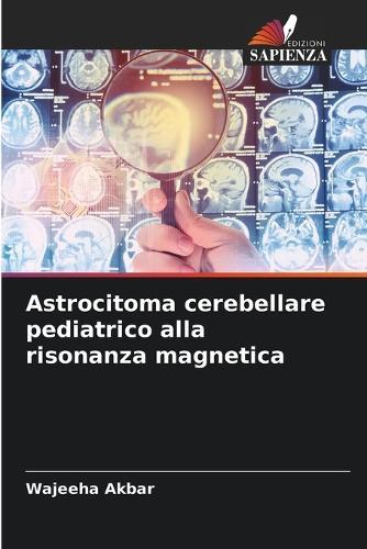 Astrocitoma cerebellare pediatrico alla risonanza magnetica