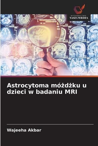 Astrocytoma móżdżku u dzieci w badaniu MRI