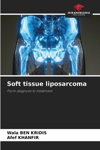 Soft tissue liposarcoma