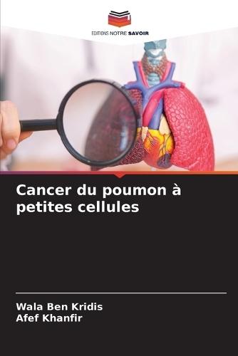 Cancer du poumon à petites cellules