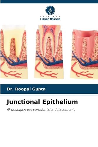 Junctional Epithelium