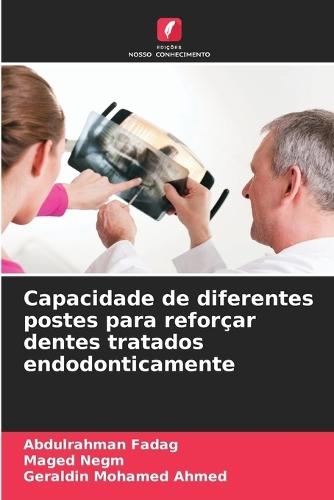Capacidade de diferentes postes para reforçar dentes tratados endodonticamente