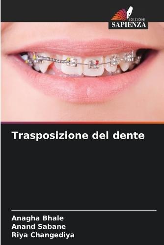Trasposizione del dente
