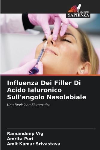 Influenza Dei Filler Di Acido Ialuronico Sull'angolo Nasolabiale