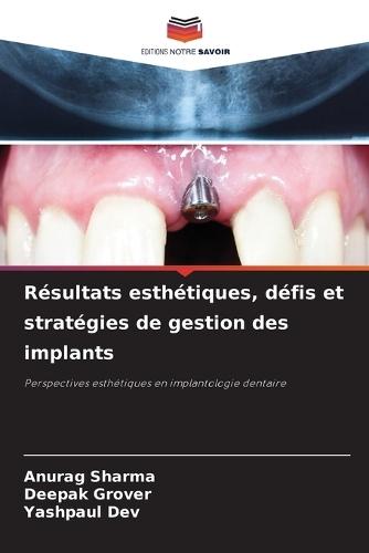 Résultats esthétiques, défis et stratégies de gestion des implants