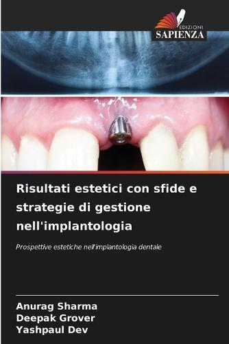 Risultati estetici con sfide e strategie di gestione nell'implantologia