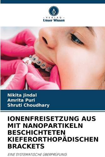 Ionenfreisetzung Aus Mit Nanopartikeln Beschichteten Kieferorthopädischen Brackets