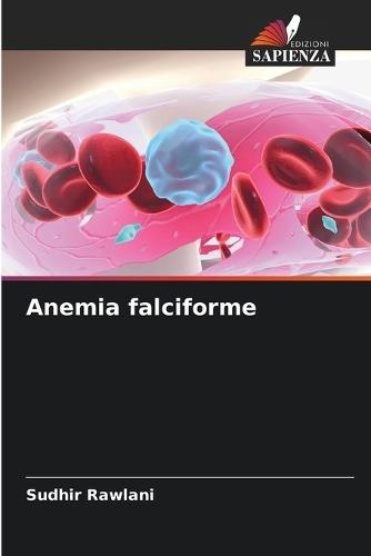 Anemia falciforme