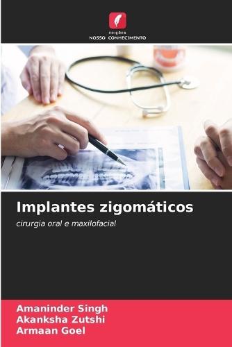 Implantes zigomáticos