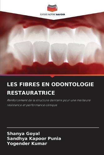 Les Fibres En Odontologie Restauratrice