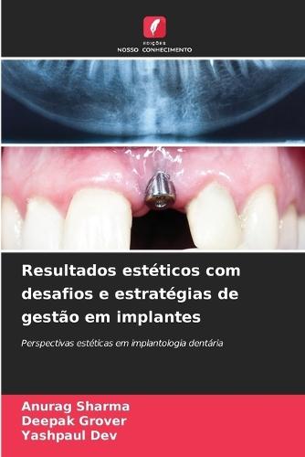 Resultados estéticos com desafios e estratégias de gestão em implantes