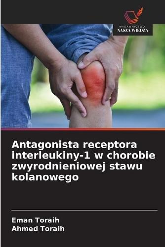 Antagonista receptora interleukiny-1 w chorobie zwyrodnieniowej stawu kolanowego