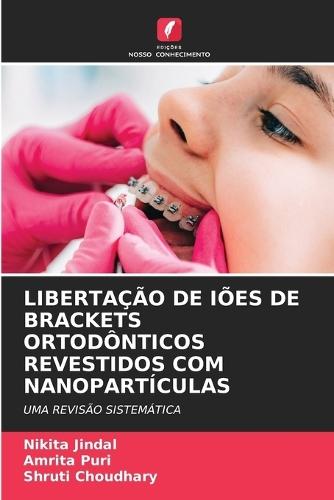 Libertação de Iões de Brackets Ortodônticos Revestidos Com Nanopartículas