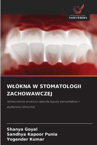 Wlókna W Stomatologii Zachowawczej