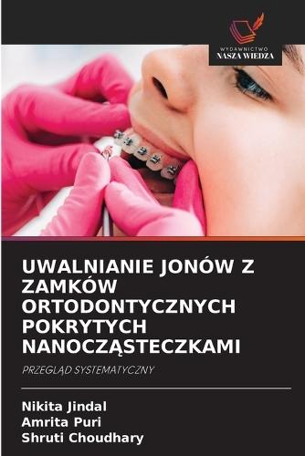 Uwalnianie Jonów Z Zamków Ortodontycznych Pokrytych NanoczĄsteczkami