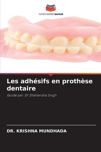 Les adhésifs en prothèse dentaire