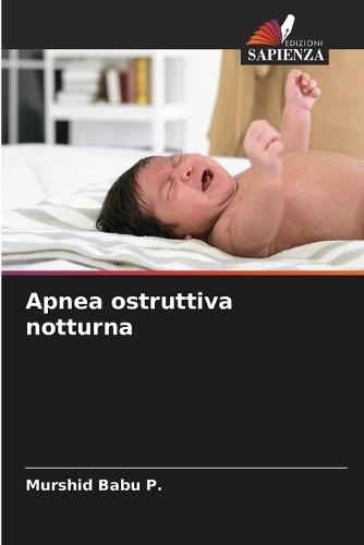 Apnea ostruttiva notturna