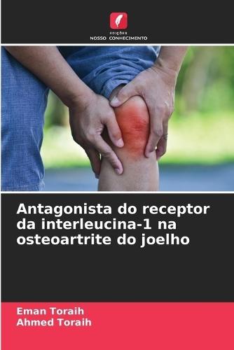 Antagonista do receptor da interleucina-1 na osteoartrite do joelho