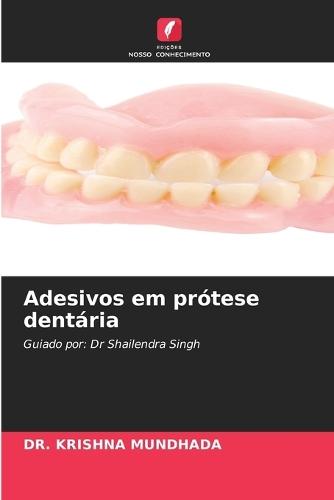 Adesivos em prótese dentária