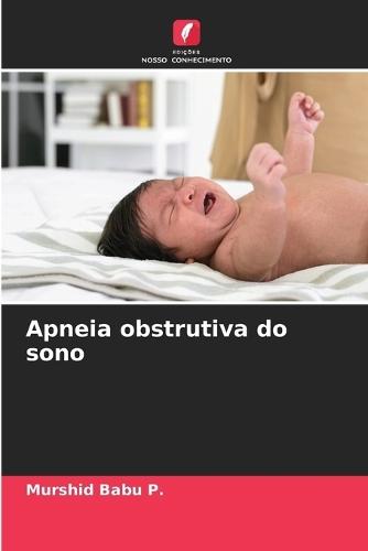 Apneia obstrutiva do sono